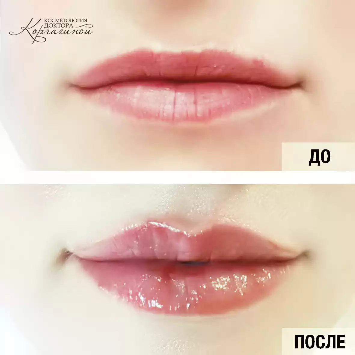 Красивые эффектные губы на фото - лучшие идеи для девушек